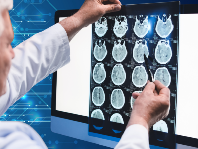 091125_AI Detects Hidden Movement Clues Linked to Brain Disorders, Study Shows (UF News)