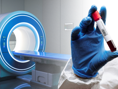 092525_Do CT Scans Increase Childhood Cancer Risk A UF Researcher Has the Answer (UF News)