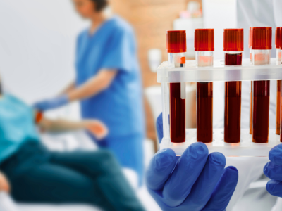 101325_Study Finds Hidden Blood Mutations Spark Obesity, Diabetes and Liver Disease (UF Health) (1)